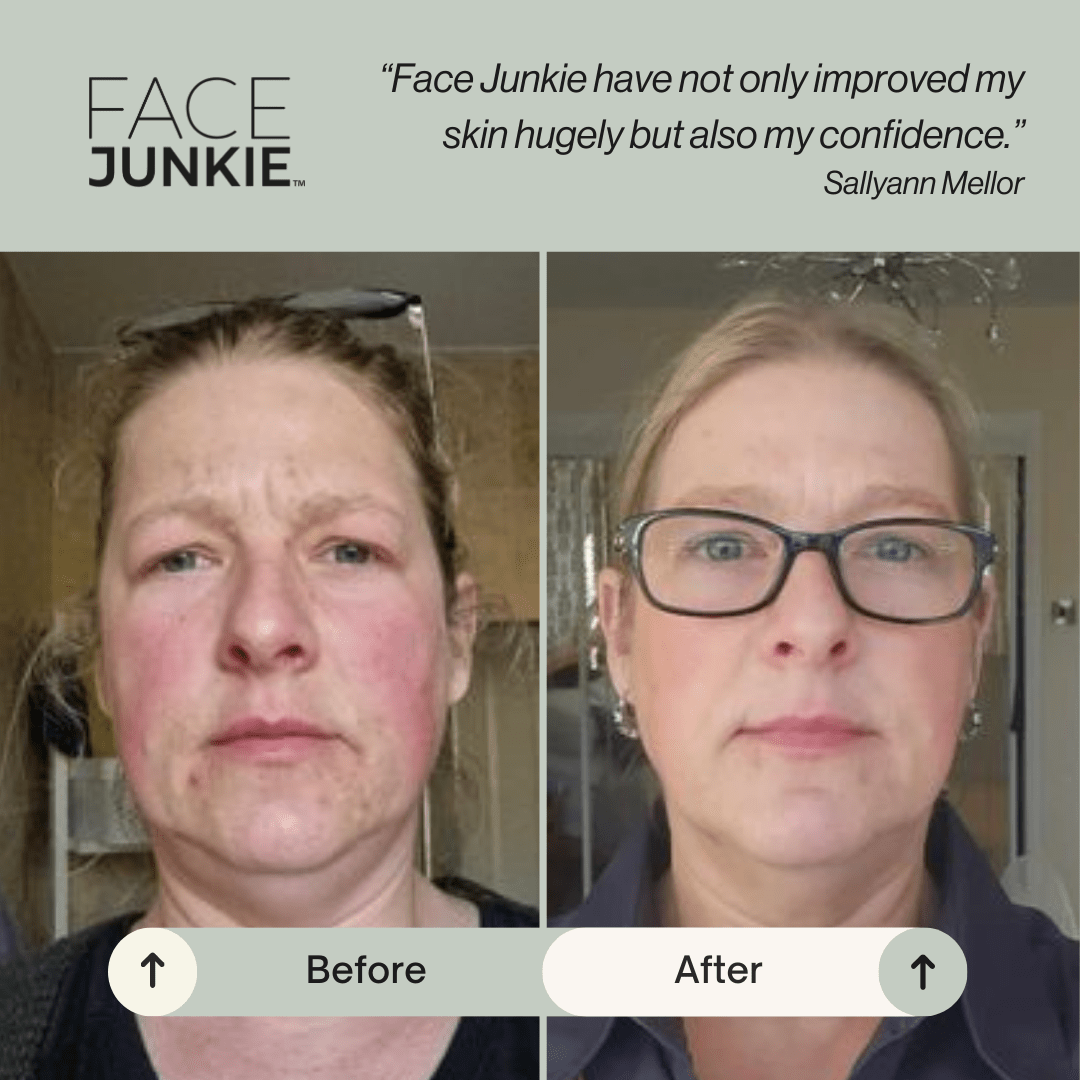Face_Junkie_compare
